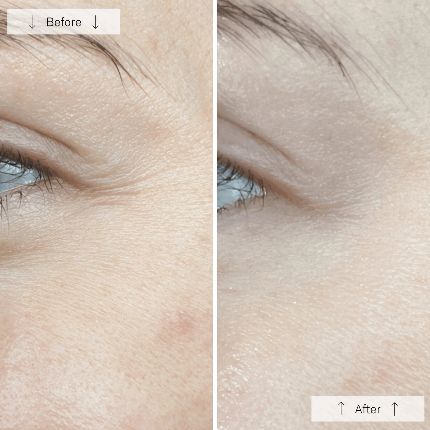 Omnilux Contour