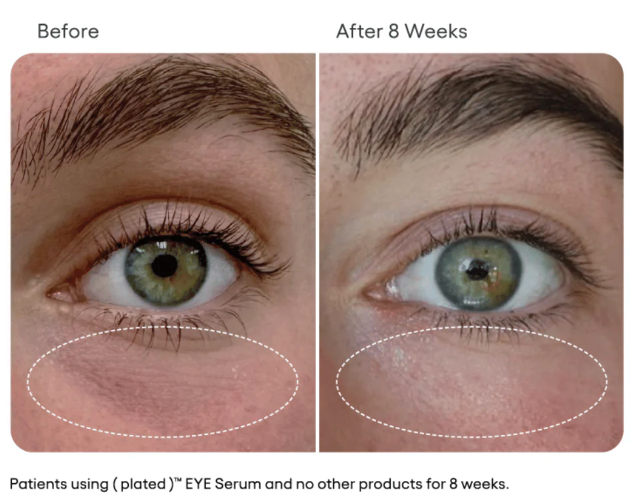 EYE Serum