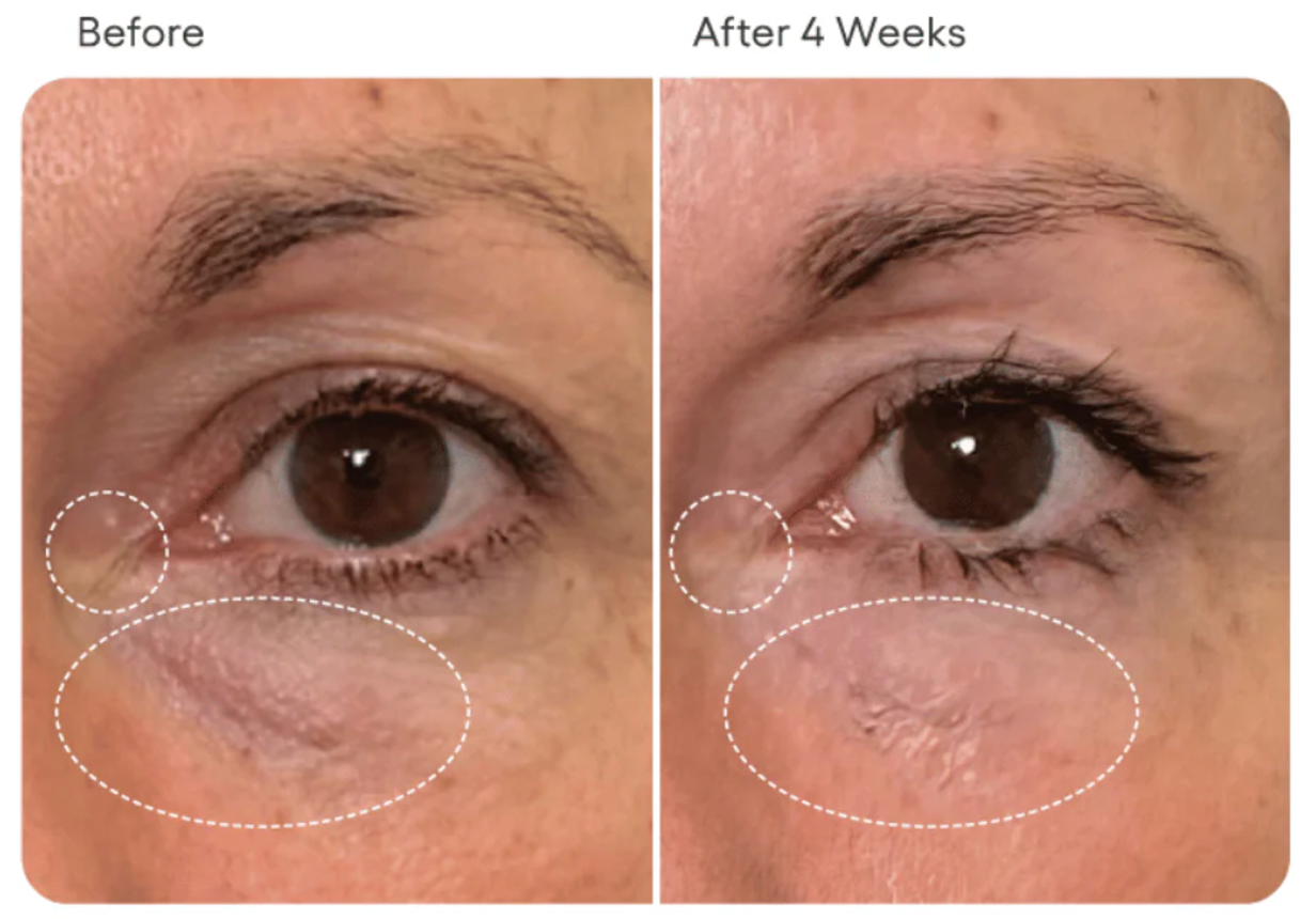 EYE Serum