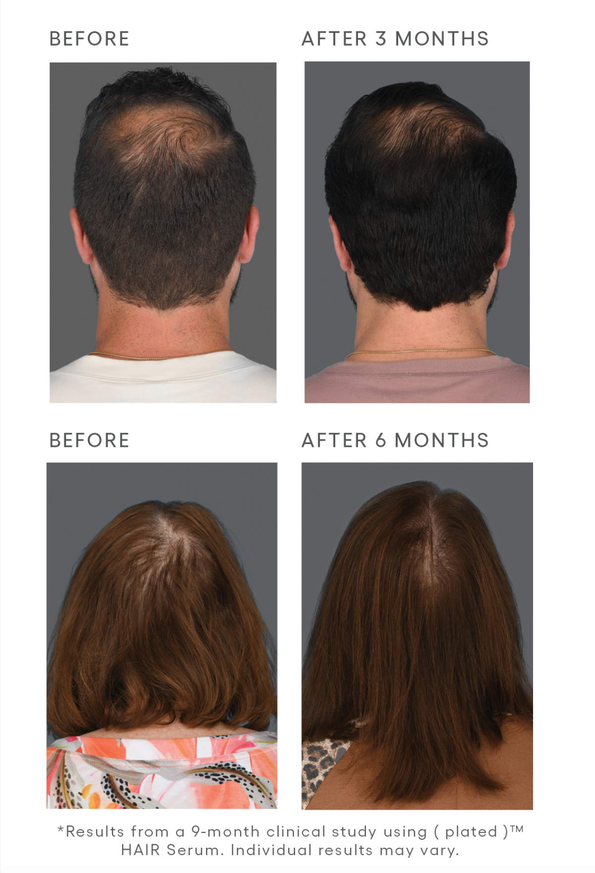 Hair Revival Duo - LIMITED TIME